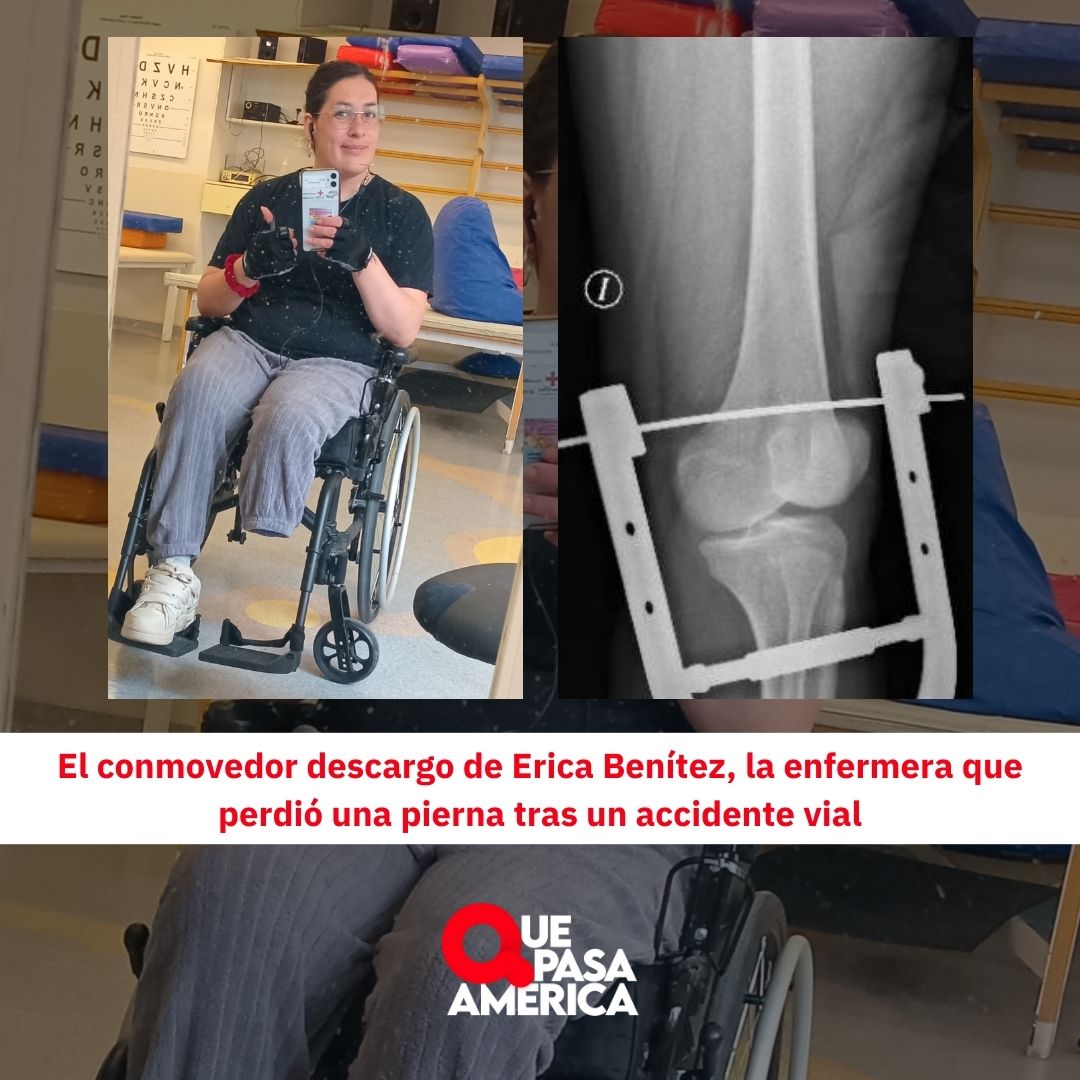 El conmovedor descargo de Erica Benítez, la enfermera que perdió una pierna tras un accidente vial
