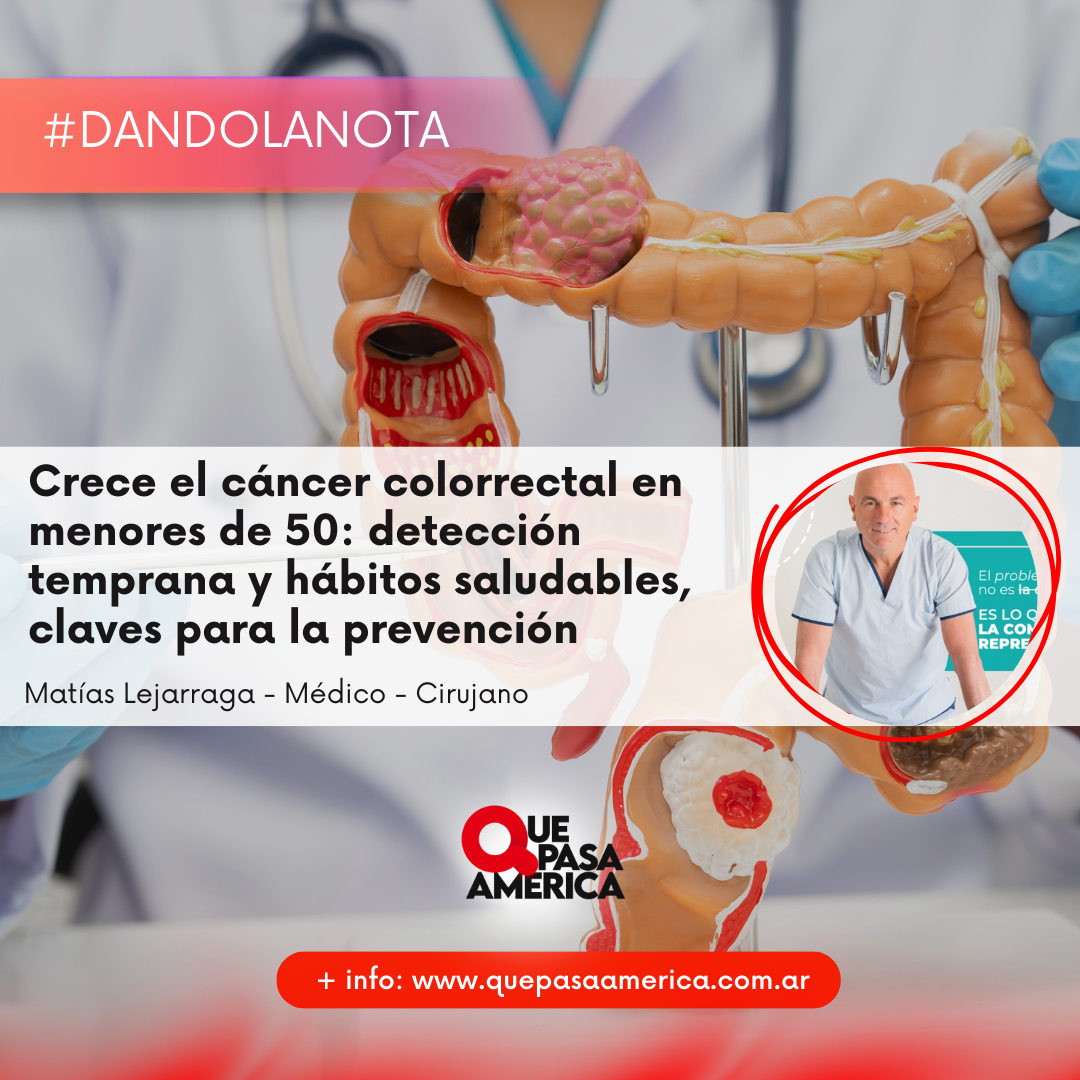 Crece el cáncer colorrectal en menores de 50: detección temprana y hábitos saludables, claves para la prevención
