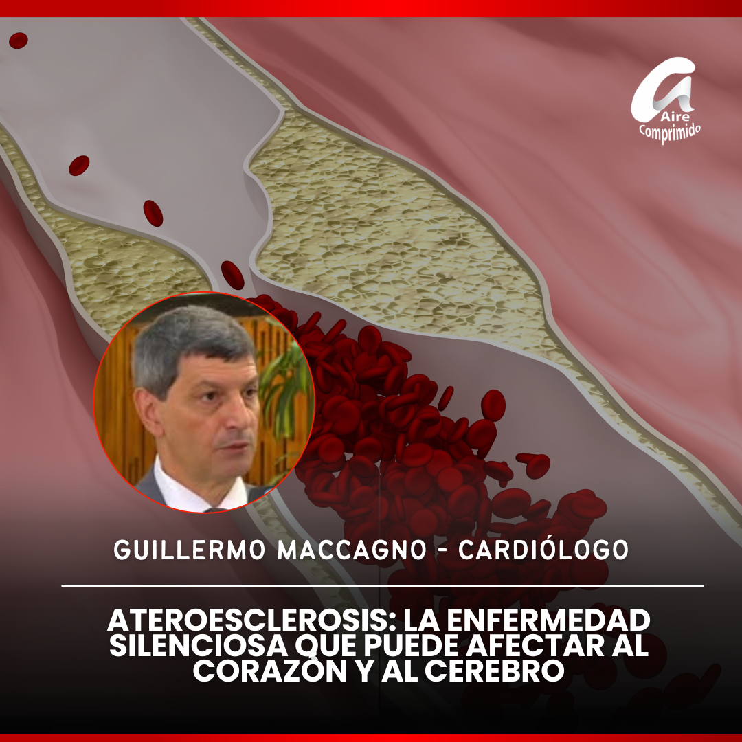 ATEROESCLEROSIS: LA ENFERMEDAD SILENCIOSA QUE PUEDE AFECTAR AL CORAZÓN Y AL CEREBRO